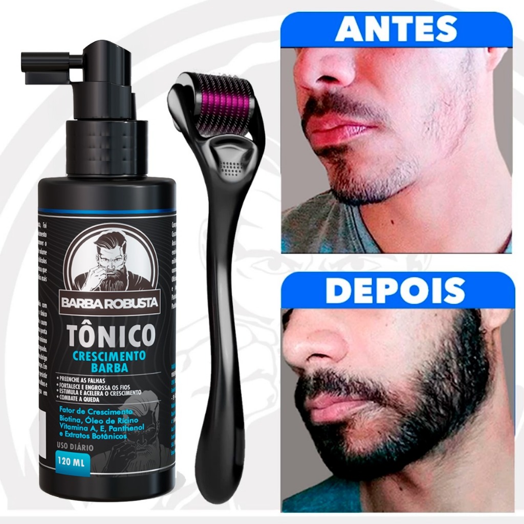 Kit Microagulhamento Dermaroller Crescimento De Barba Cabelo
