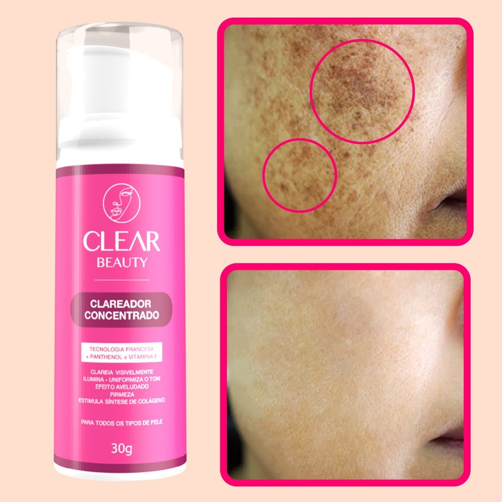 Clareador De Axilas e Virilhas Creme Clareador Partes Intimas Clear Beauty – Envio Rápido