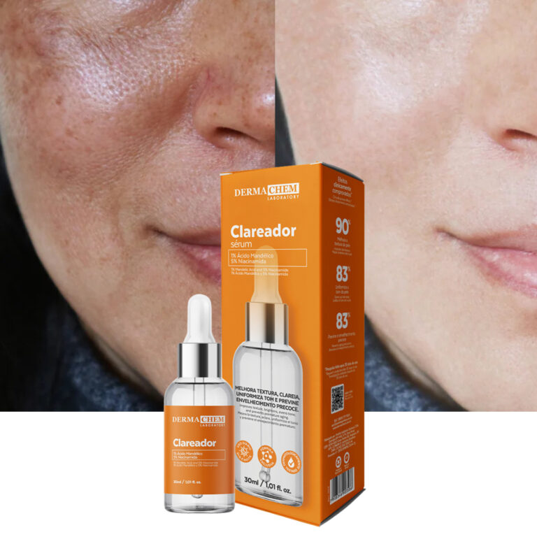 Sérum Clareador Dermachem de Melasma Uniformiza o