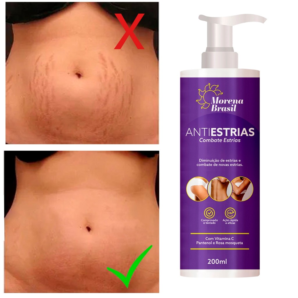 Creme Anti-Estrias 200ml ElaEEla – Adeus às Estrias