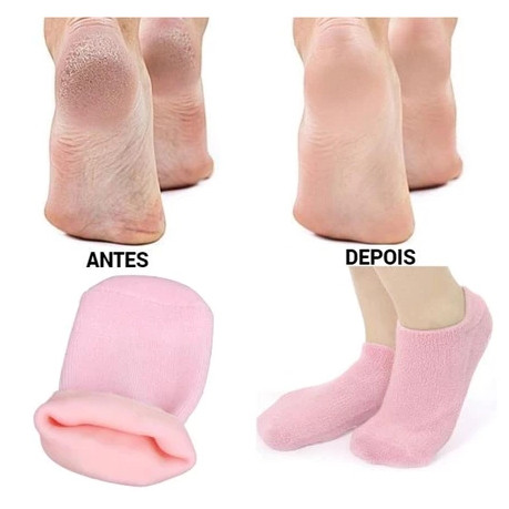 Kit Meias e Luvas de Hidratação Para Os Pés e M