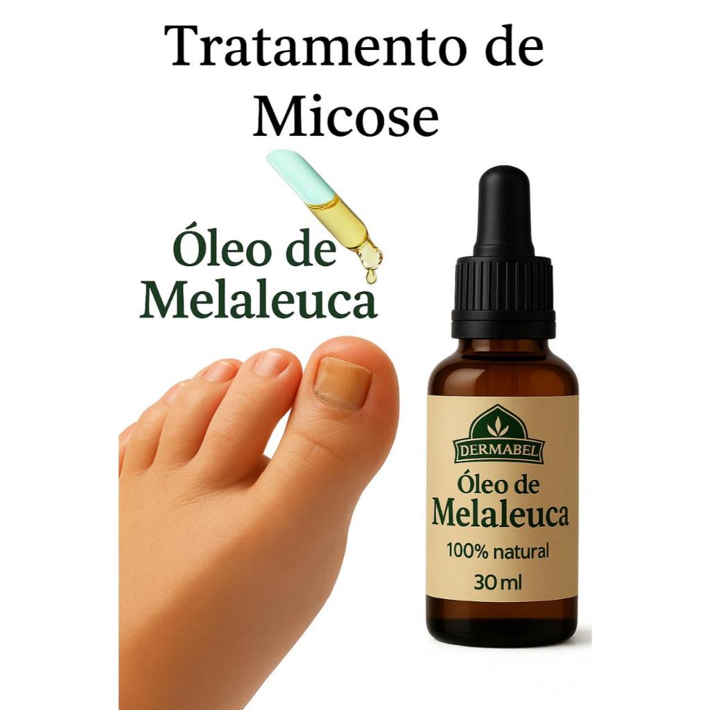 Óleo de Melaleuca 30ml Combate Micose Unhas Oleosidade Acne e Fortalece os Cabelos Dermabel Tea Tree