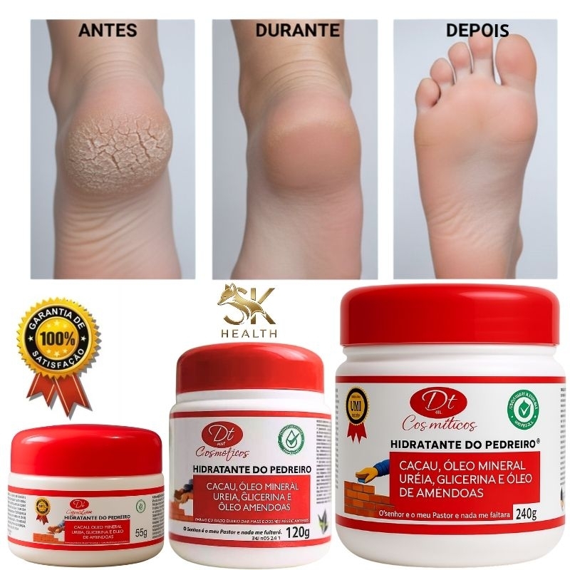 Creme de Ureia 240g Hidratante do Pedreiro | Tratamento Potente para Pés Rachados, Mãos, Joelhos e C