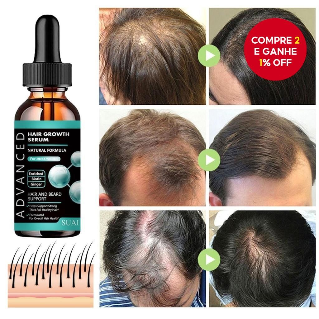 Óleo De Crescimento De Barba Masculino-Fórmula Rápida De Espessamento De Cabelo Para Mais Completa E