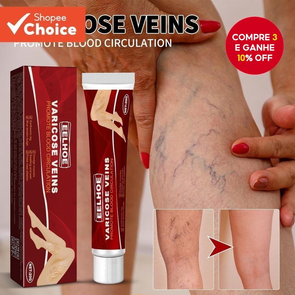 20g De Creme Para Veias Varicosas Com Gerânio , Lentilha E Erva-Mãe | Previne A Recuperação , Fórmul