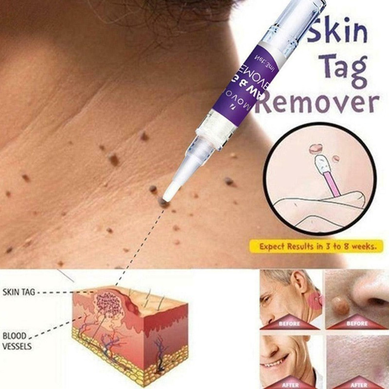 Essência De Gel Para Cuidados Com A Pele