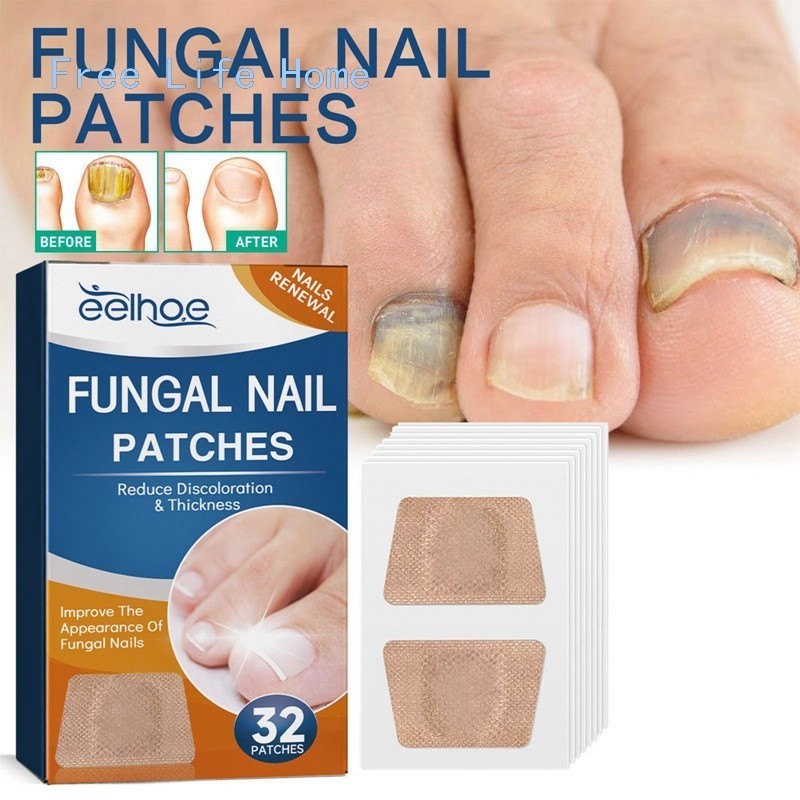 32 Adesivos Antifúngicos Para Tratamento De Unhas , Reparos De Onicomicose weilaisj
