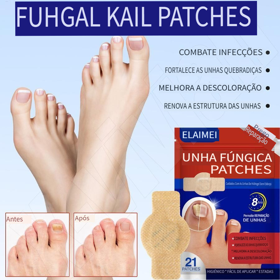 [Entrega 24 horas]Trate todos os tipos de fungos nas unhas,Rápida absorção e fácil de usar-Transport