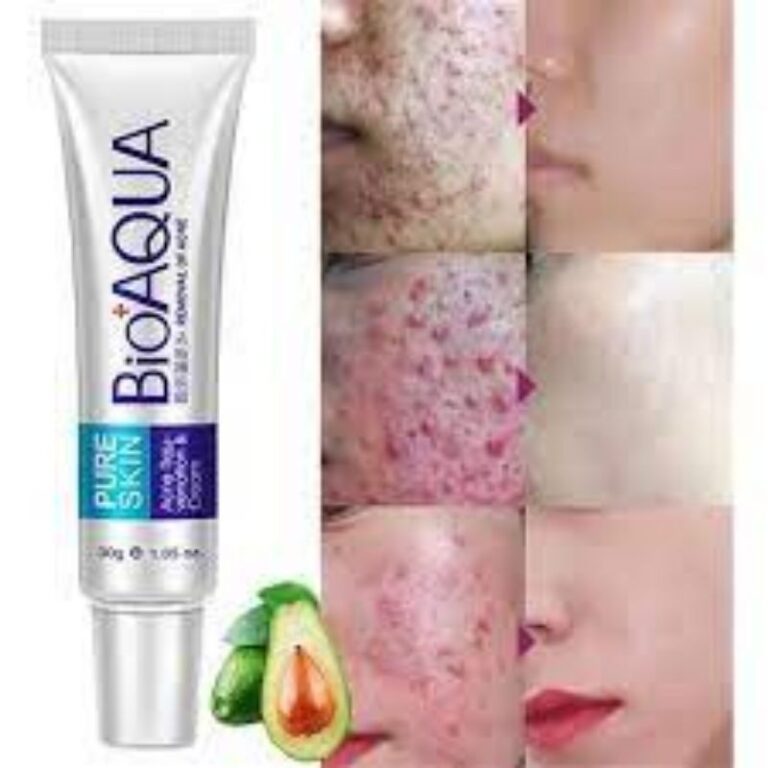 Creme Bioaqua Removal Anti Acne Cravos e Espinhas 