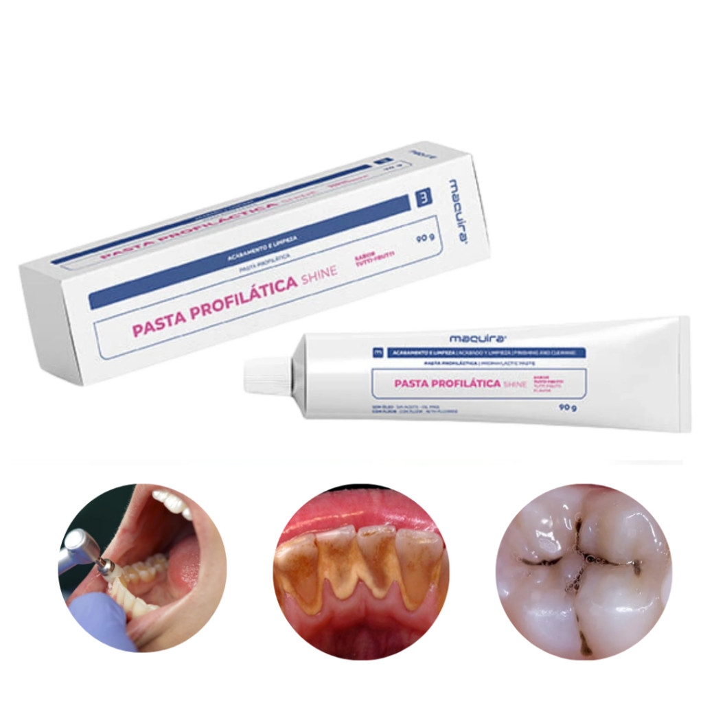 Pasta Profilática Odontológica 90 Gramas Shine – Maquira