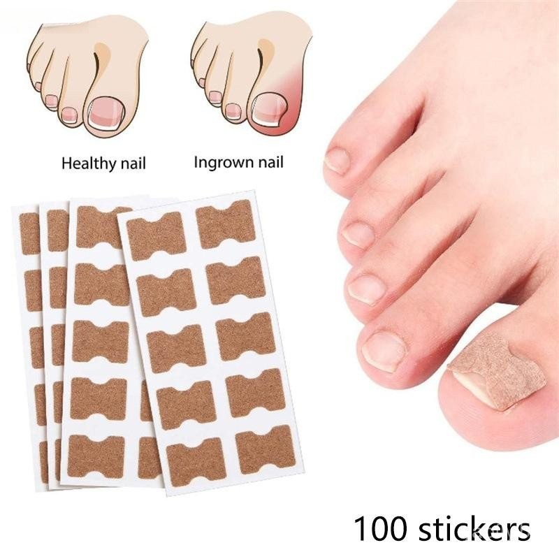 100 Unidades Adesivo Para Fungos Nas Unhas Pegajoso Reparo De Correção Encravada Cuidados Com As Par