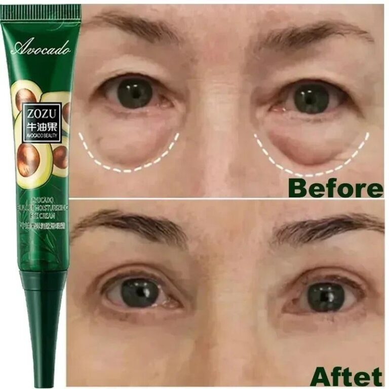 Creme instantâneo anti-rugas para os olhos, anti-