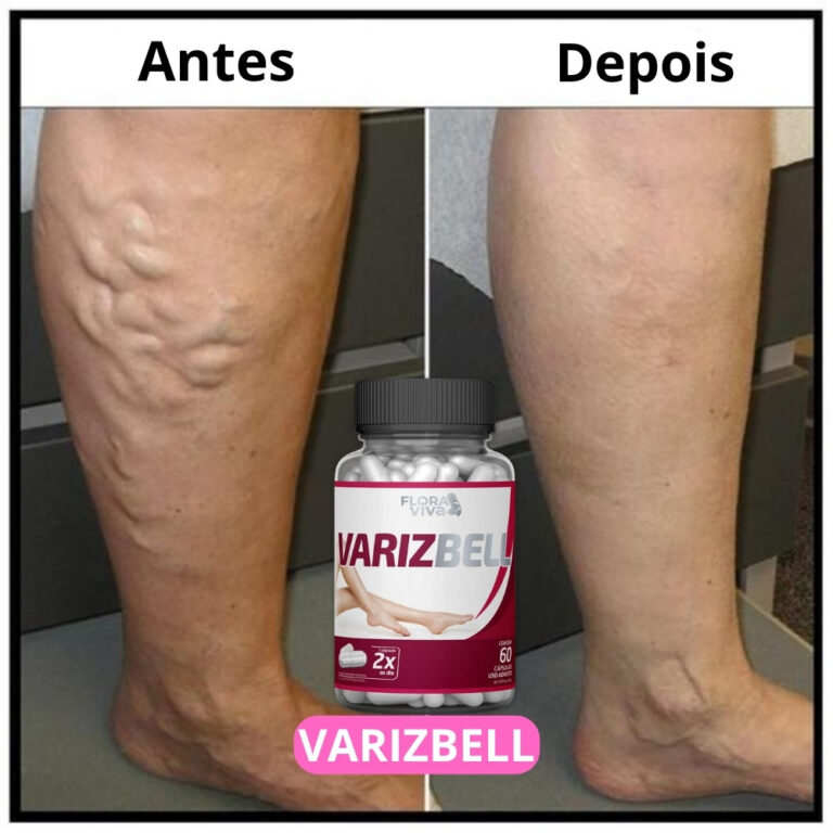Varizbel Para remover Varizes, Dores e inchaços, 