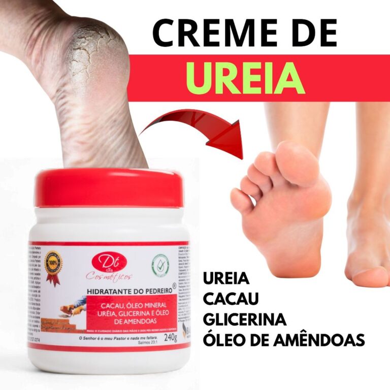 Creme De Ureia Hidratante De Pedreiro 500g Para P�
