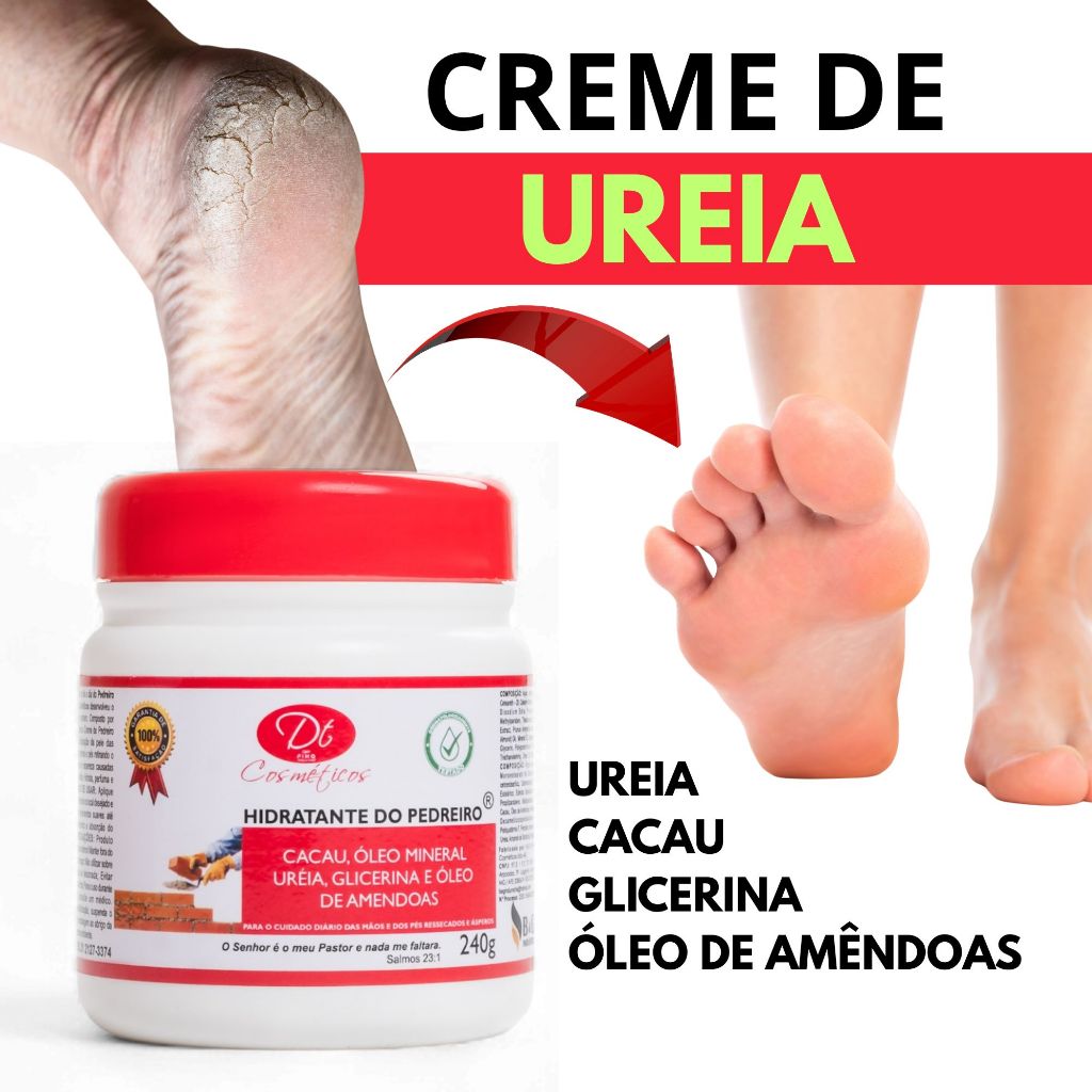Creme De Ureia Hidratante De Pedreiro 500g Para Pés Rachados Ressecados Vários Tamanhos