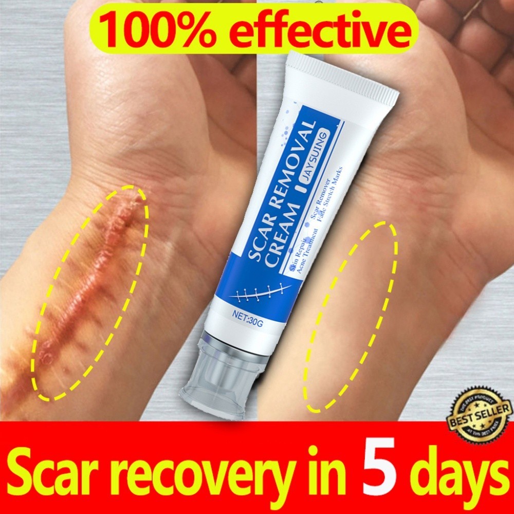 Advanced Scar 30g Creme Reparador Com Centella , Manteiga De Karité E Esqualano-Seguro Para Gravidez