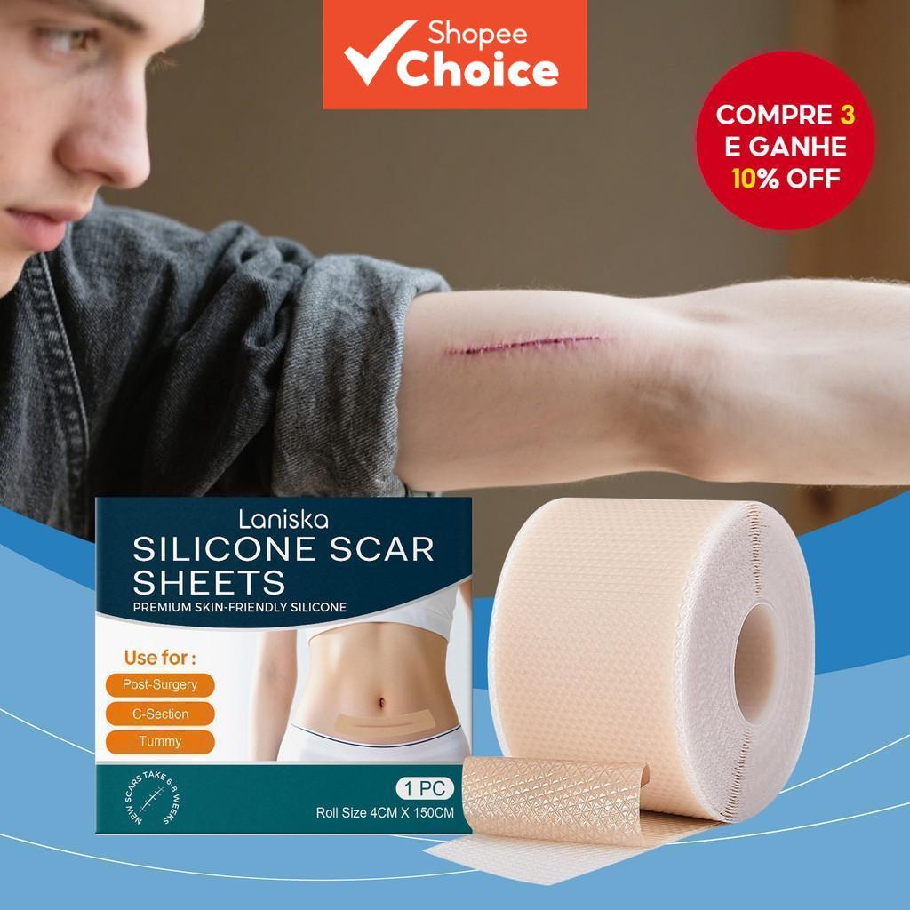 Fita de Silicone Antiadesiva para Cicatrizes: Solução Suave para Cuidados com Cicatrizes Cirúrgicas,