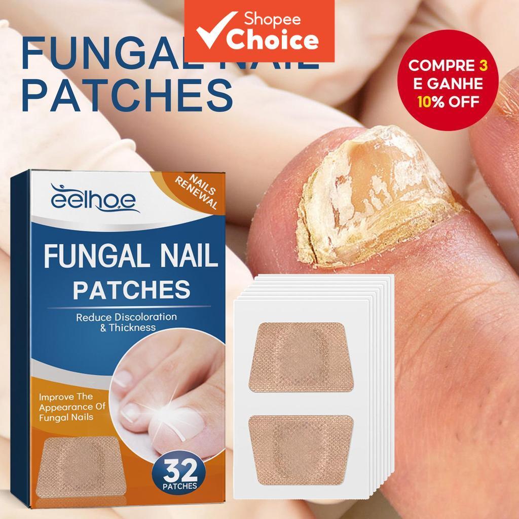 Reparação De Unhas Para Pés 32/64 Peças Remendo Cinza Fúngicas Engrossar Infecção De Paroníquia Maci
