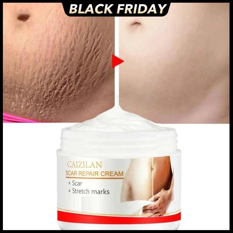 Creme Reparador De Cicatrizes , Cuidados Com A Pele , Remoção De Estrias , Tratamento Para Mulheres