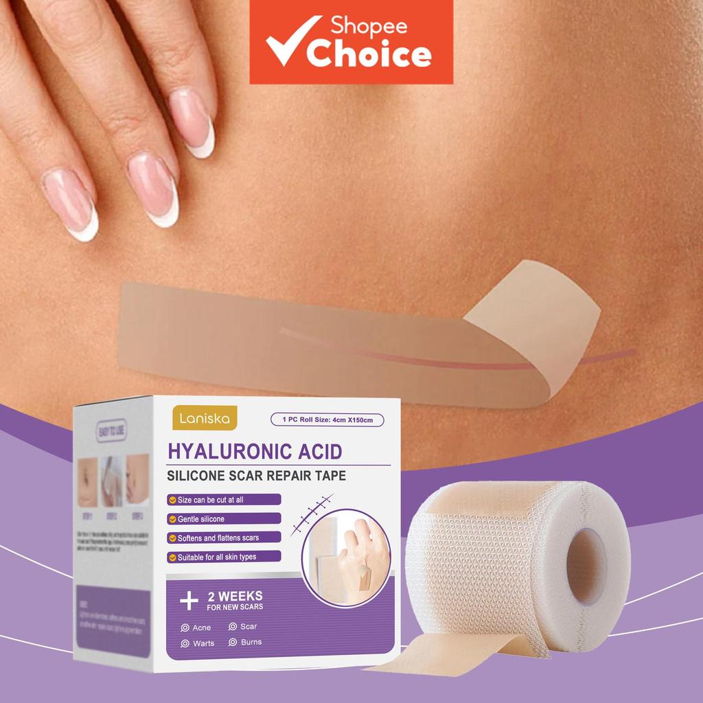 Fita de Reparo de Microagulhas de Ácido Hialurônico, Fita de Silicone para Cicatrizes, Fita de Sili