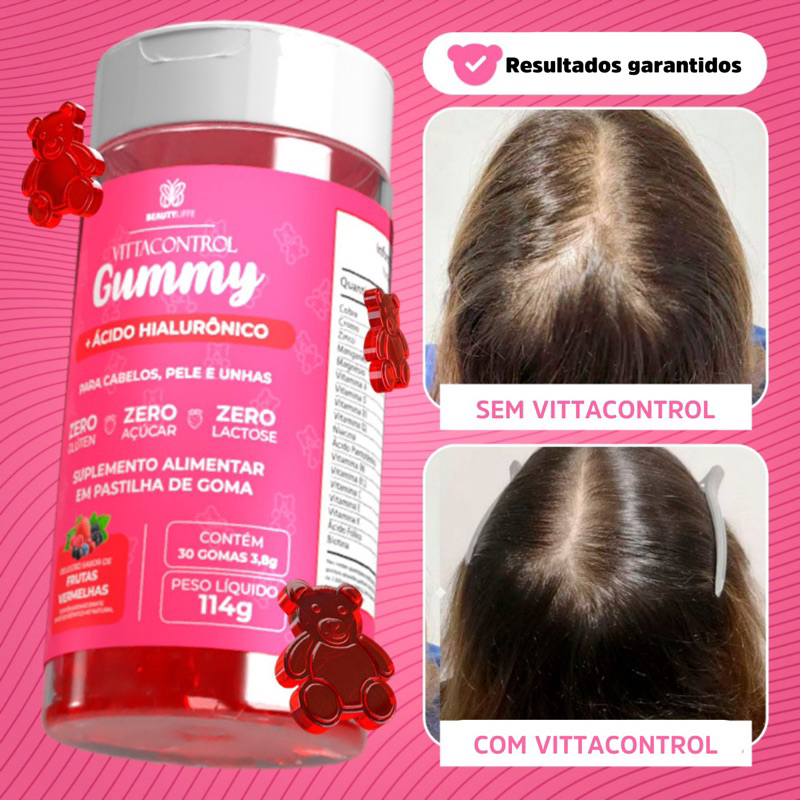 Vitamina Capilar Gummy + Ácido Hialurônico Vitta