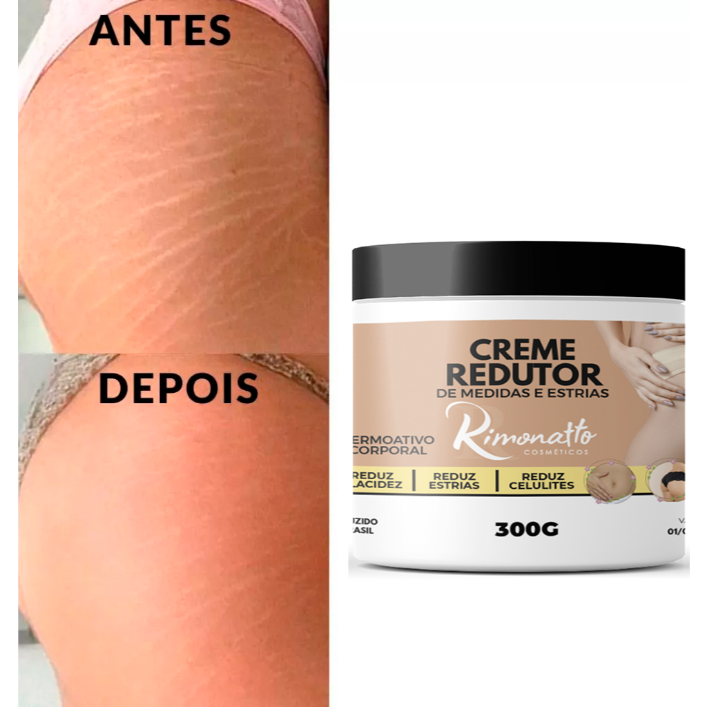 Creme hidratante de ureia Anti Estrias Removedor d