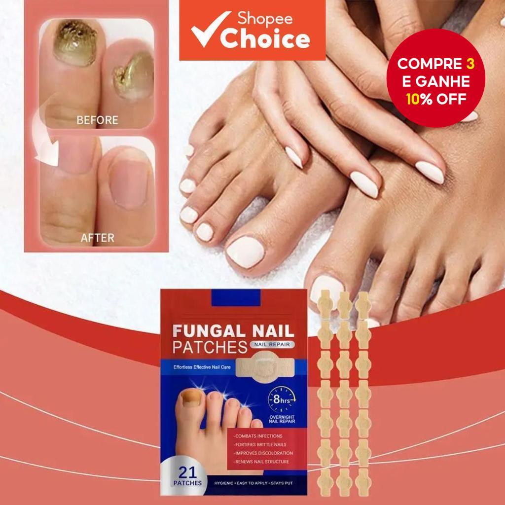 NOVO 21Pçs Adesivo para Fungo de Unha Impermeáve