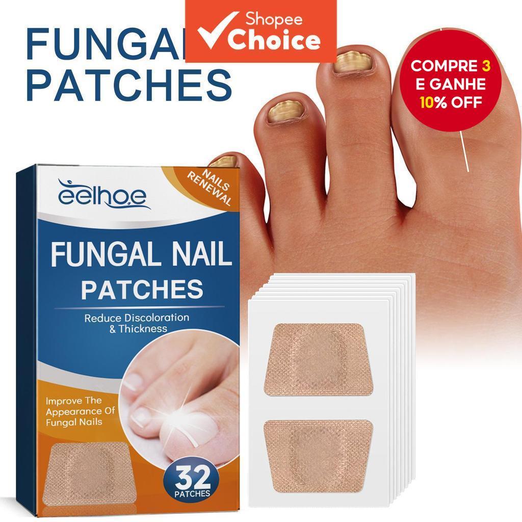 32 peças adesivo de correção de unhas dos pés 