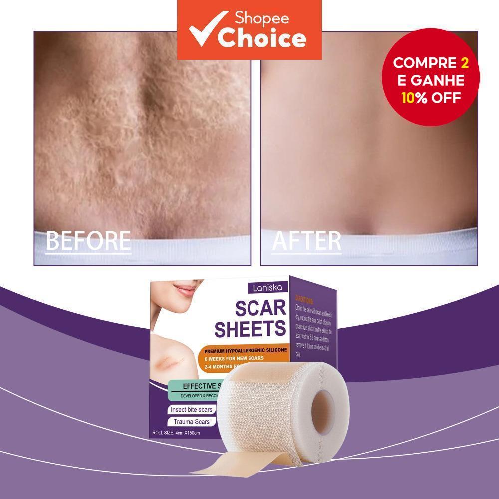 Folhas de Silicone para Cicatrizes, Fita de Silico