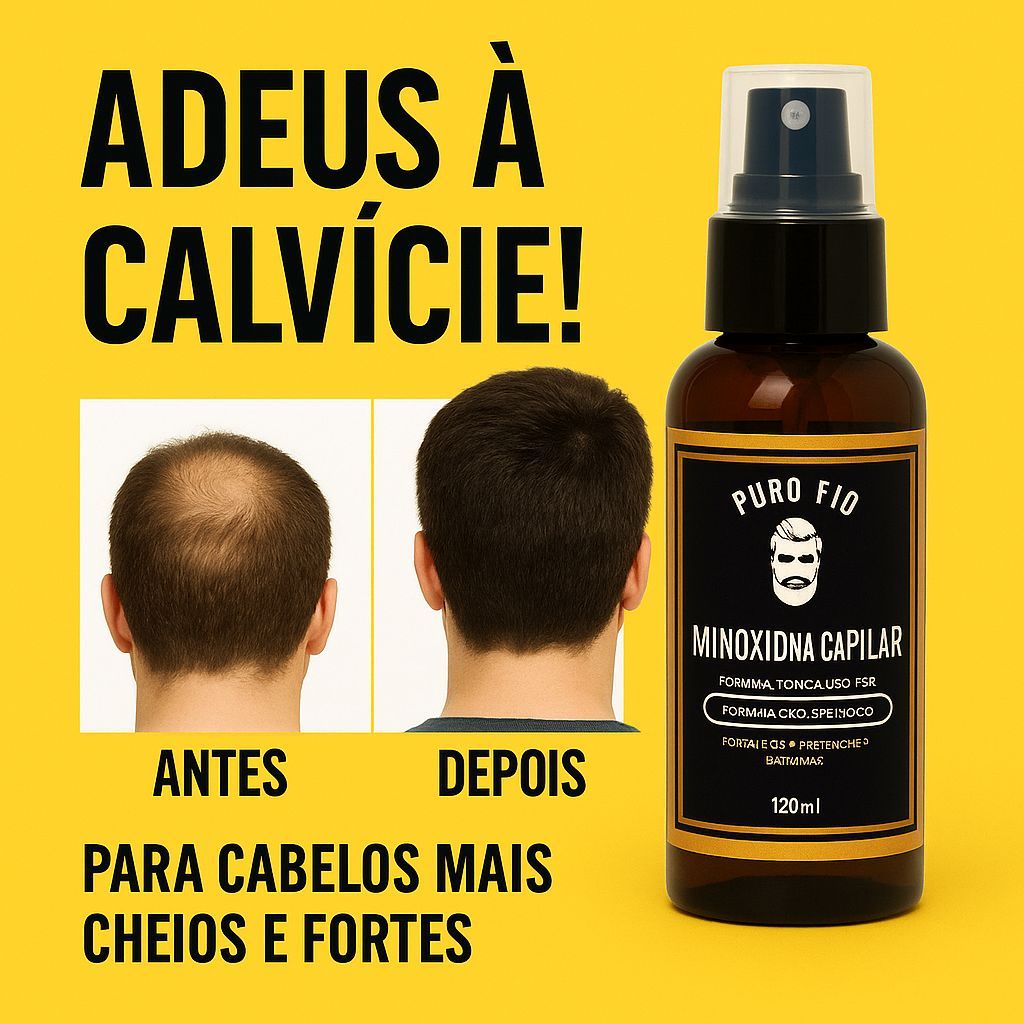 Tônico Capilar 15% Anti Queda Serum de Cresciment