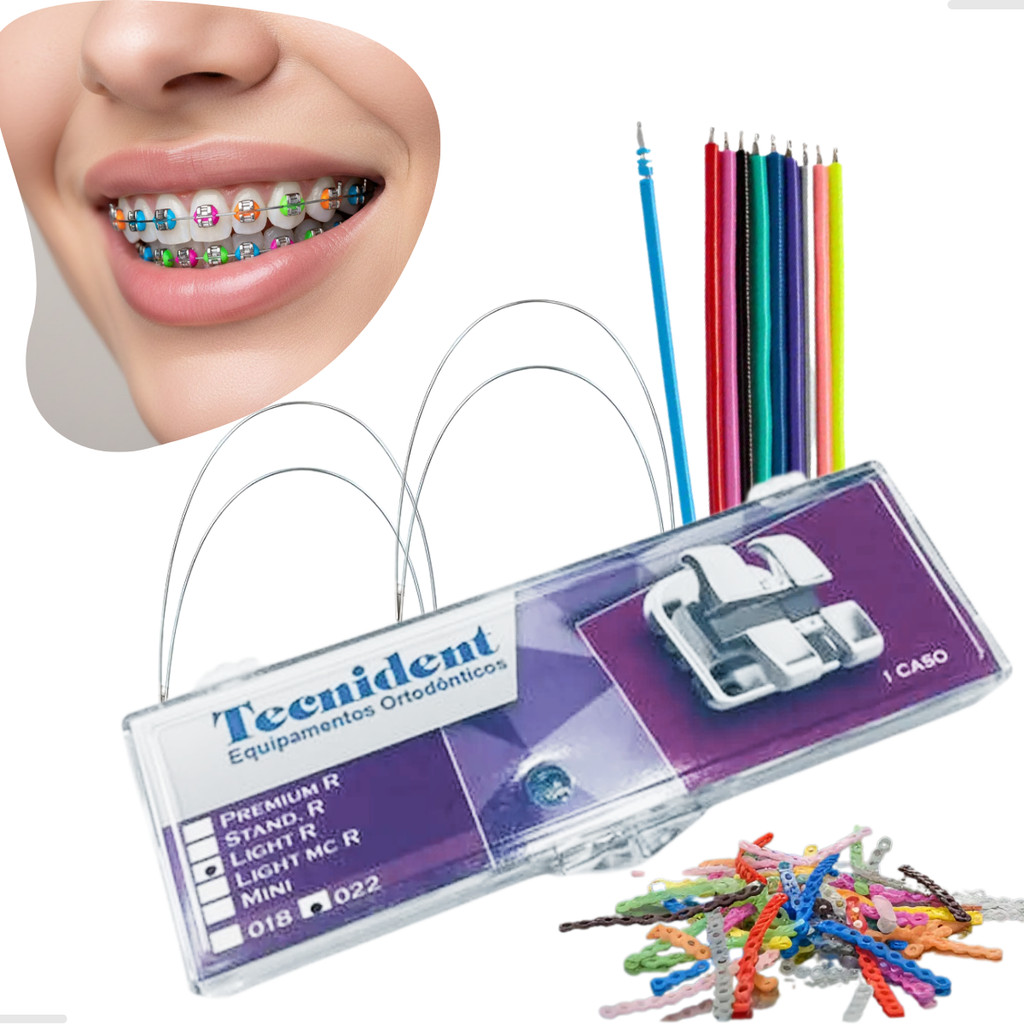 Kit Aparelho 01 Caixa de Braquete + 1000 Borrachin