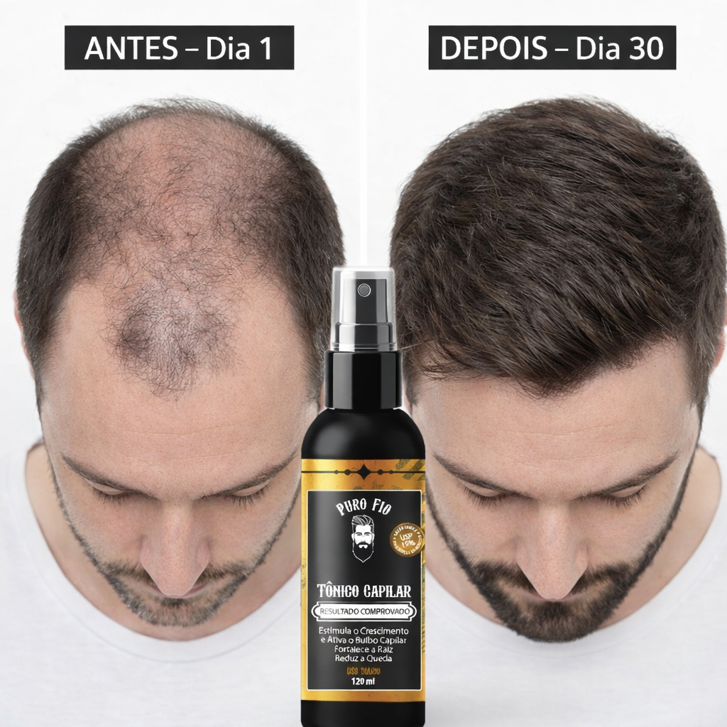 Tônico Capilar 15% Anti Queda Serum de Cresciment