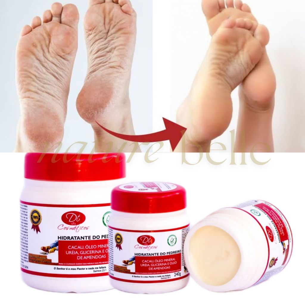 Creme Hidratante De Uréia 240g Creme De Pedreiro 