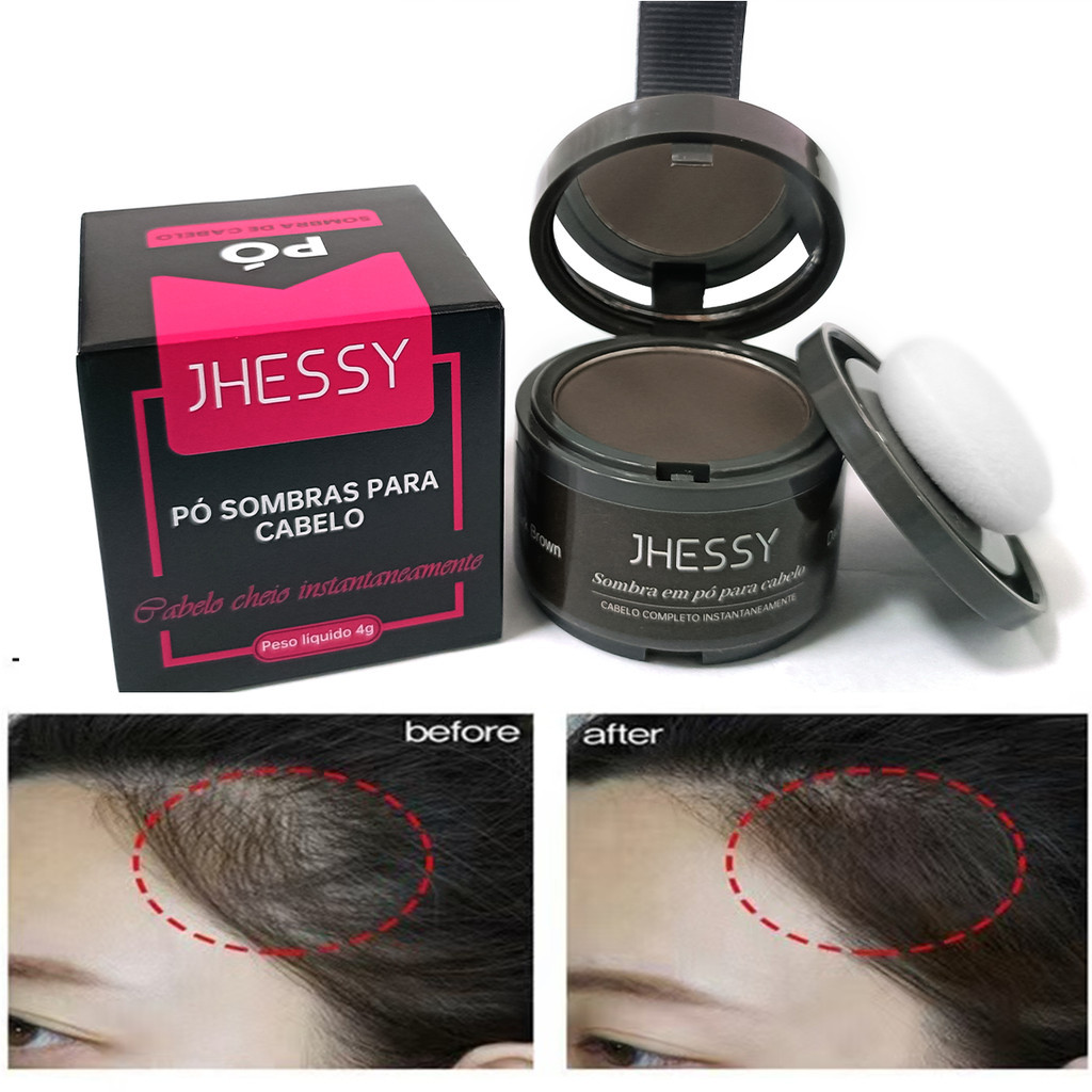 O pó para cobertura de cabelo pode cobrir a calv�