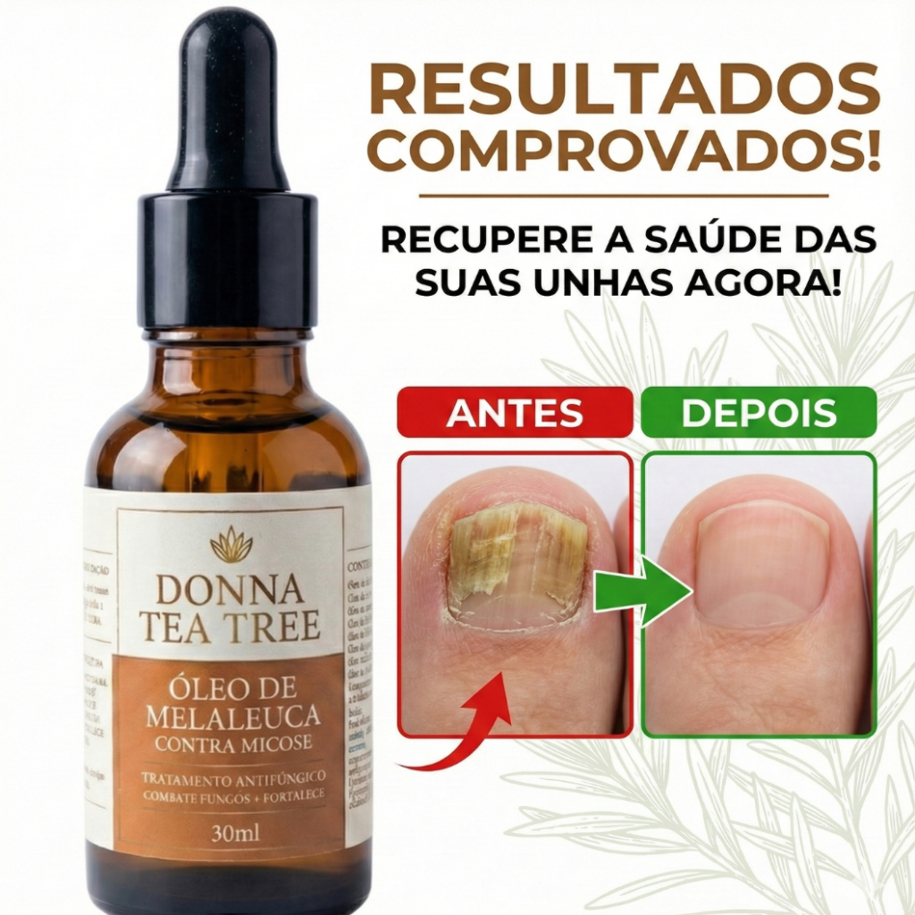 Óleo de Melaleuca Tea Tree Donna 30ml Antifúngic