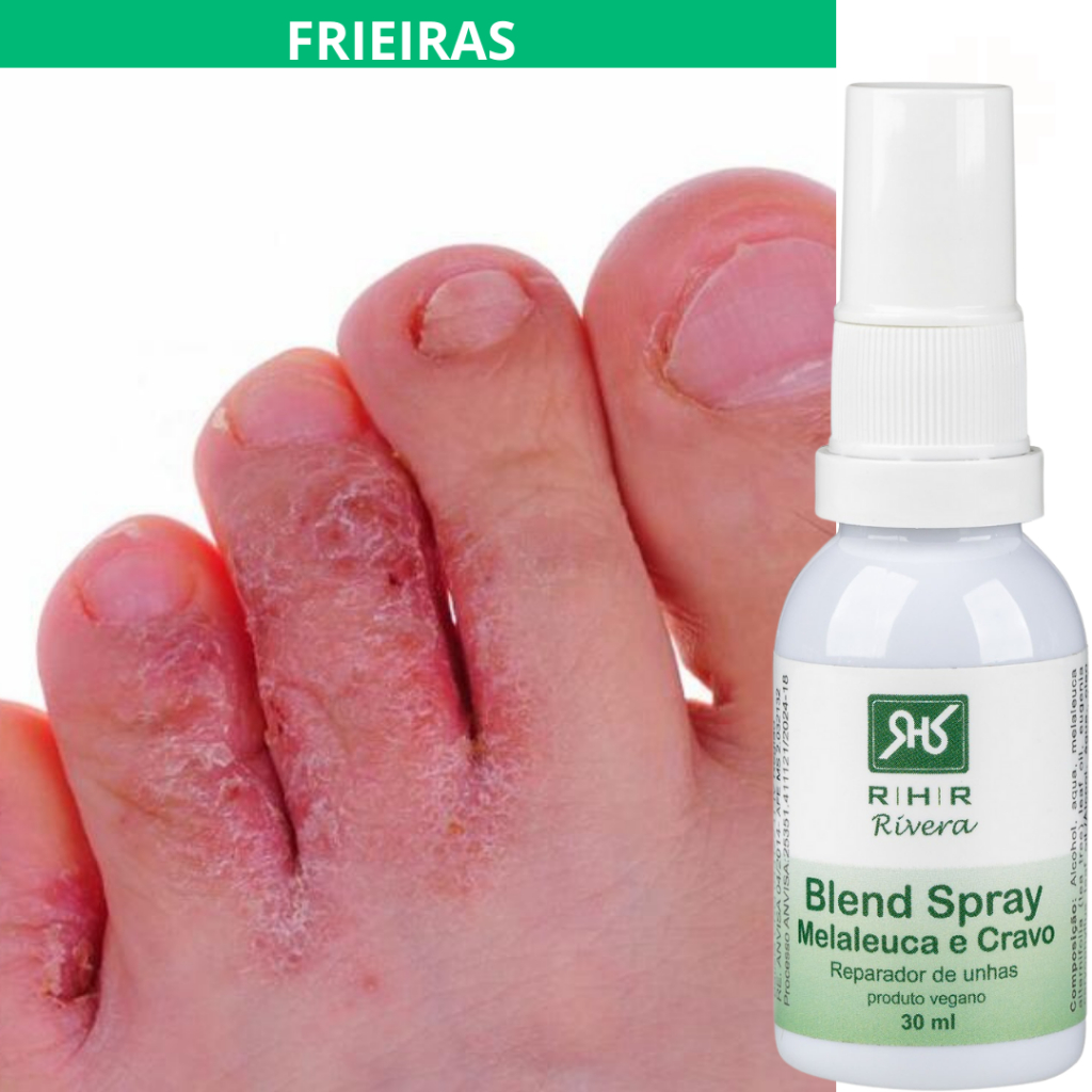 Remédio para Frieiras – Blend Spray –