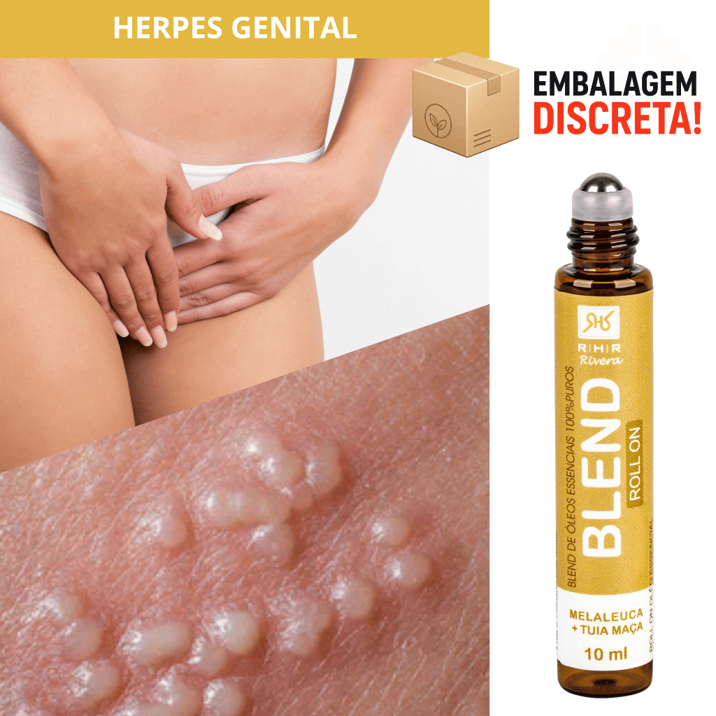 Herpes Genital – Blend Roll-on 10ml
