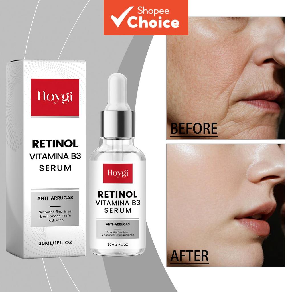 Sérum Hidratante Anti-Envelhecimento 30ml  Retino