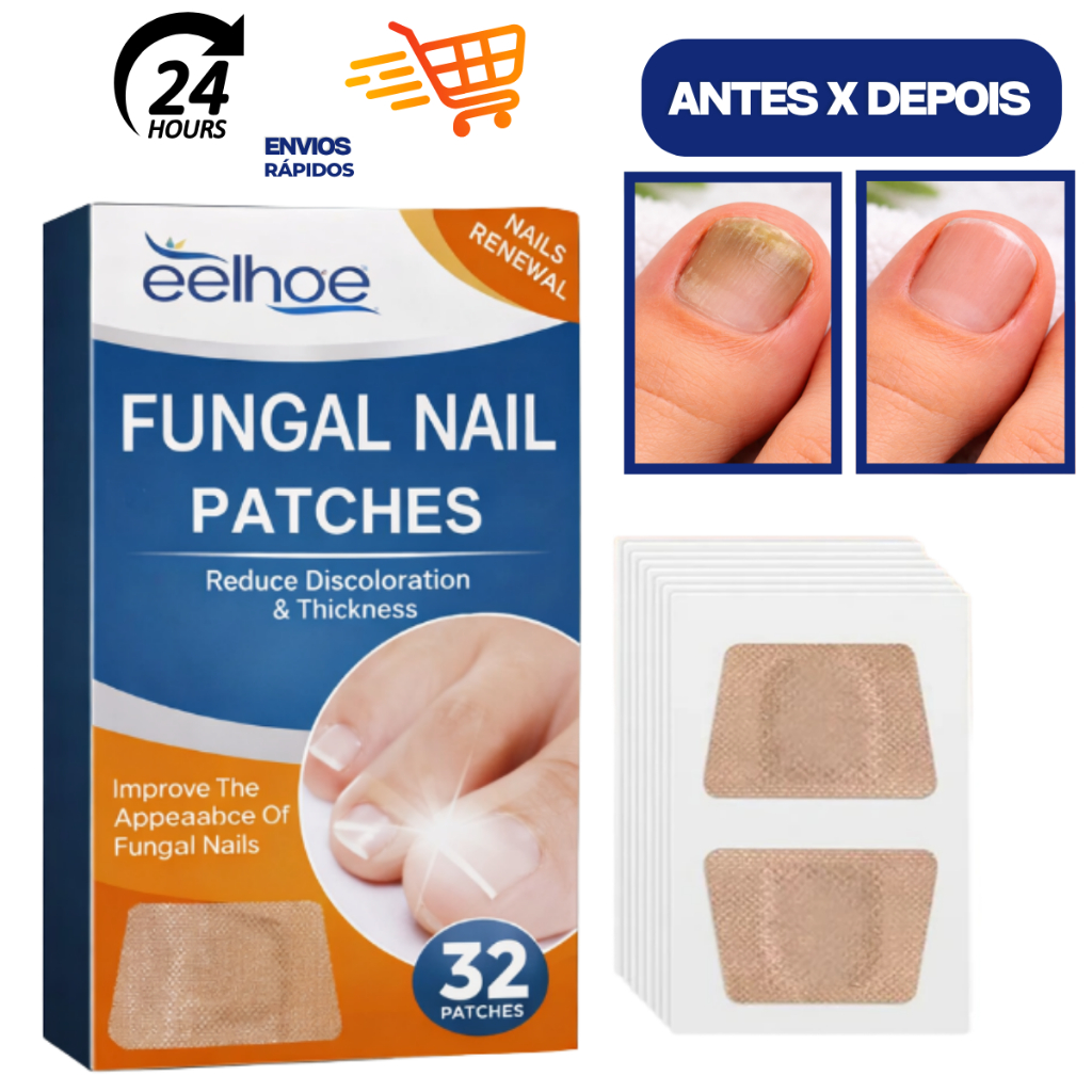 Kit Adesivo Reparador de Unhas dos Pés Fungo Unha