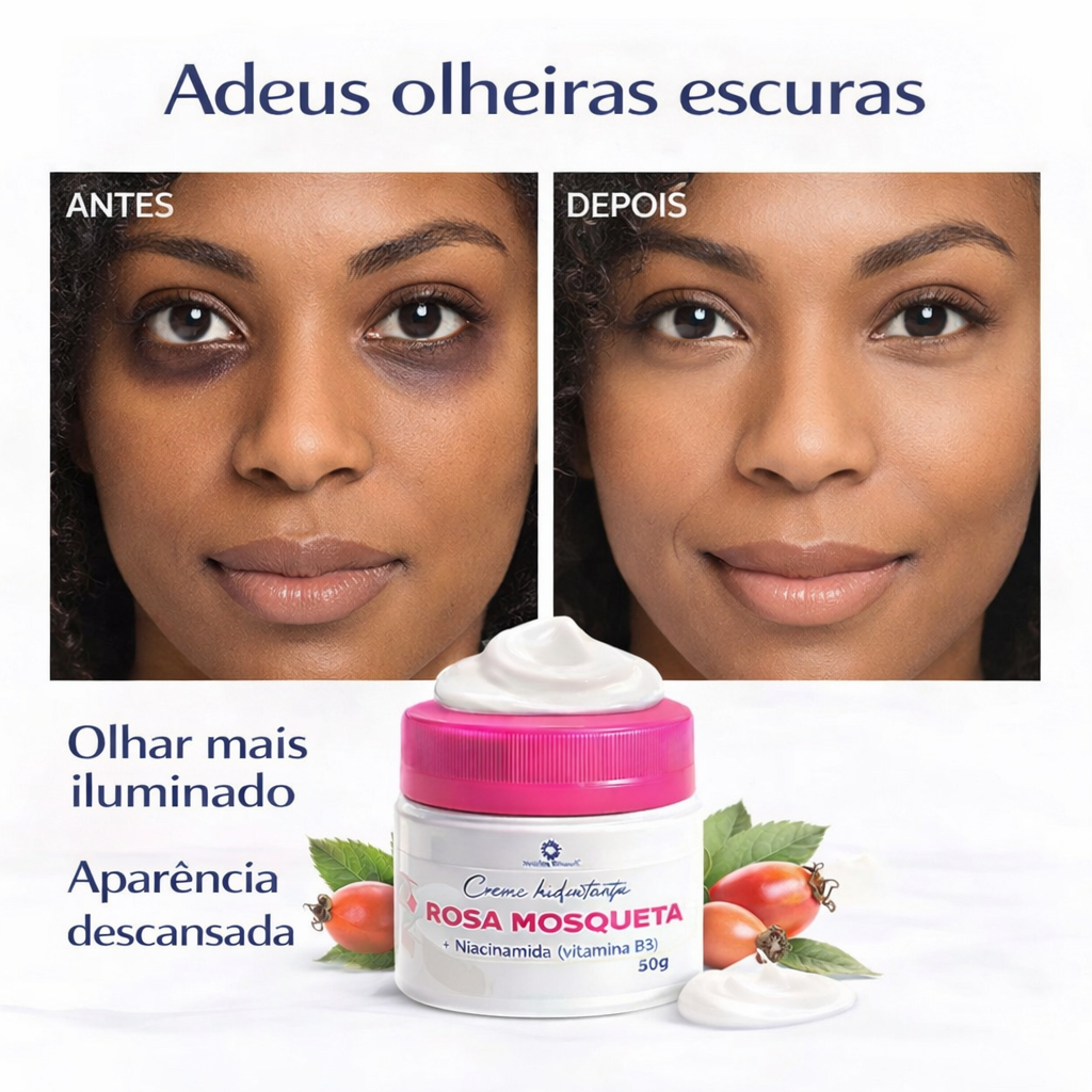 Creme rosa mosqueta clareador para olheiras areas 