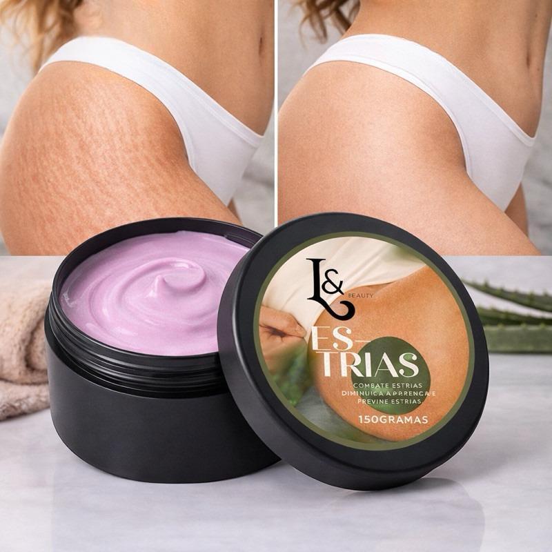 Creme removedor de estrias Trata e previne –
