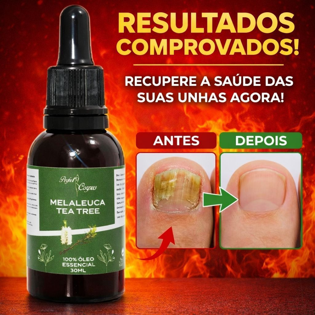 Óleo Melaleuca Essencial Embalagem Contra Gotas 1