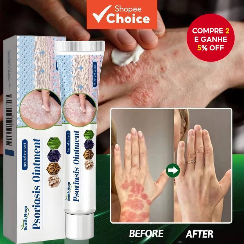 Creme Antibacteriano para Psoríase Lua do Sul Erv