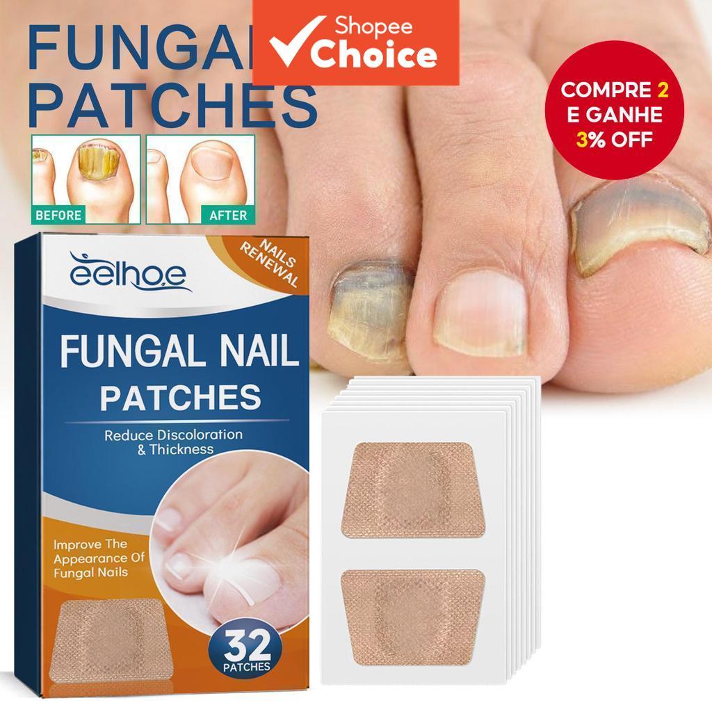 Adesivos Para Unhas Fúngicas EELHOE | Tratamento 