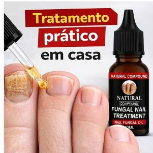 Tratamento para Micose de Unha Antifúngico Óleo 
