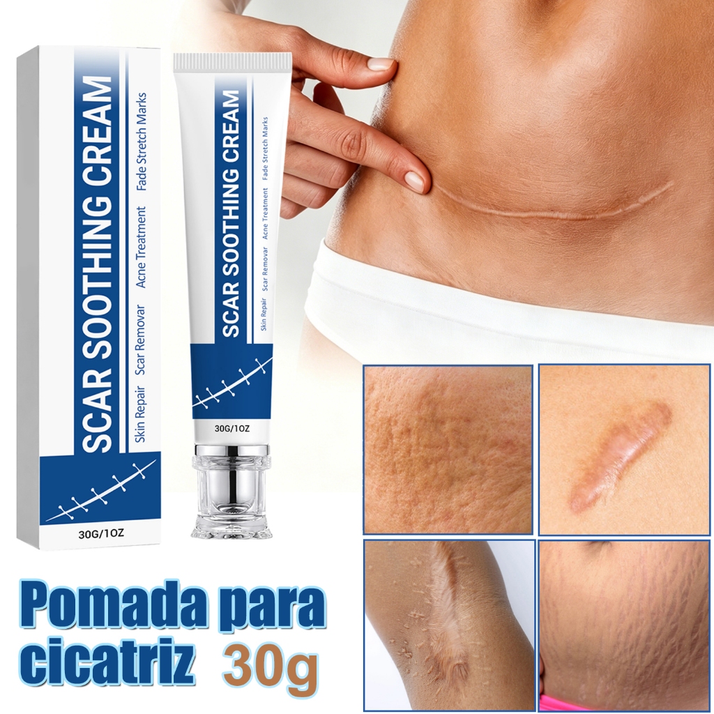 Pomada eficaz para remoção de cicatrizes pode se