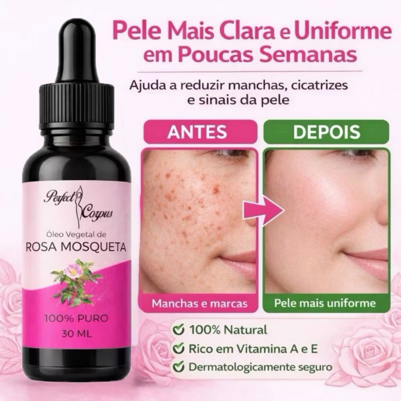 Óleo Vegetal De Rosa Mosqueta 100% Puro Natural P