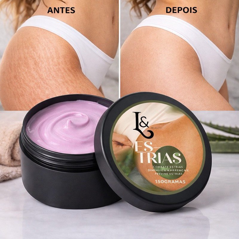 Creme Redutor De Estrias Trata E Previne 150g R